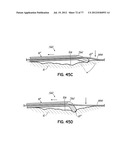 SYSTEMS, DEVICES AND METHODS FOR TREATING THE HEART WITH ABLATION diagram and image