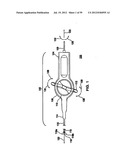 Remotely Controlled Catheter Insertion System with Automatic Control     System diagram and image