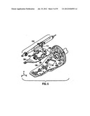 Remotely Controlled Catheter Insertion System with Automatic Control     System diagram and image