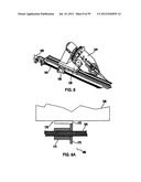 Remotely Controlled Catheter Insertion System with Automatic Control     System diagram and image