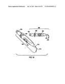 Remotely Controlled Catheter Insertion System with Automatic Control     System diagram and image