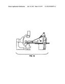 Remotely Controlled Catheter Insertion System with Automatic Control     System diagram and image