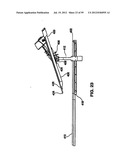 Remotely Controlled Catheter Insertion System with Automatic Control     System diagram and image