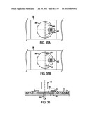 Remotely Controlled Catheter Insertion System with Automatic Control     System diagram and image