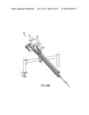 Remotely Controlled Catheter Insertion System with Automatic Control     System diagram and image