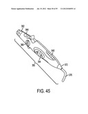 Remotely Controlled Catheter Insertion System with Automatic Control     System diagram and image