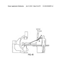 Remotely Controlled Catheter Insertion System with Automatic Control     System diagram and image