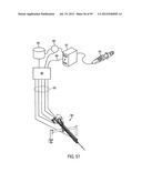 Remotely Controlled Catheter Insertion System with Automatic Control     System diagram and image