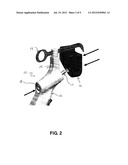 KNEE ARTHROPLASTY APPARATUS AND METHOD diagram and image