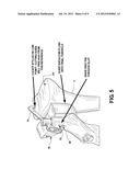 KNEE ARTHROPLASTY APPARATUS AND METHOD diagram and image