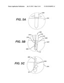 BIOABSORBABLE SUTURE ANCHOR SYSTEM FOR USE IN SMALL JOINTS diagram and image