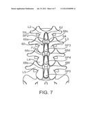 METHODS AND SYSTEMS FOR CONSTRAINT OF MULTIPLE SPINE SEGMENTS diagram and image