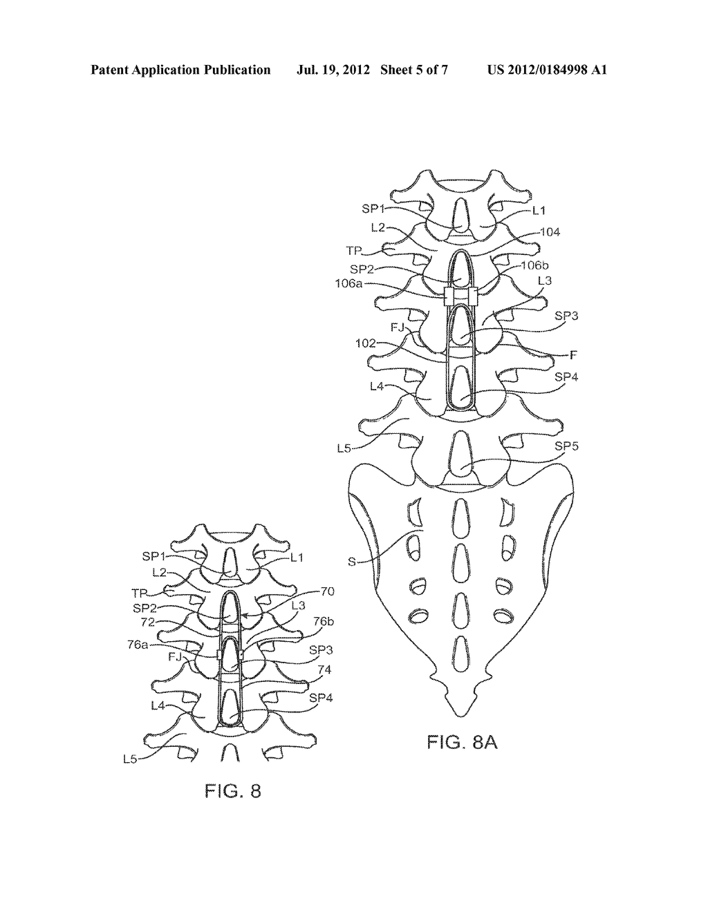 METHODS AND SYSTEMS FOR CONSTRAINT OF MULTIPLE SPINE SEGMENTS - diagram, schematic, and image 06