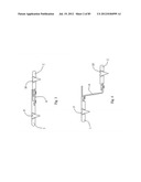 Decompressive Craniotomy Device and Methodology diagram and image