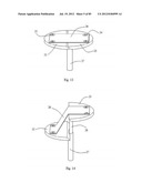 Decompressive Craniotomy Device and Methodology diagram and image