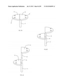 Decompressive Craniotomy Device and Methodology diagram and image