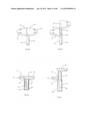 Decompressive Craniotomy Device and Methodology diagram and image