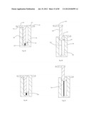 Decompressive Craniotomy Device and Methodology diagram and image