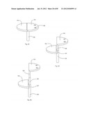 Decompressive Craniotomy Device and Methodology diagram and image