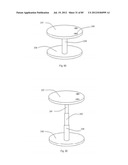 Decompressive Craniotomy Device and Methodology diagram and image