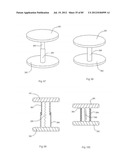 Decompressive Craniotomy Device and Methodology diagram and image