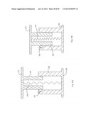 Decompressive Craniotomy Device and Methodology diagram and image