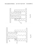 Decompressive Craniotomy Device and Methodology diagram and image