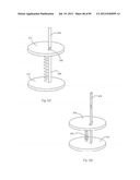 Decompressive Craniotomy Device and Methodology diagram and image