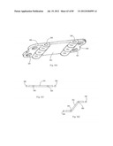 Decompressive Craniotomy Device and Methodology diagram and image