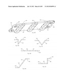 Decompressive Craniotomy Device and Methodology diagram and image