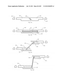 Decompressive Craniotomy Device and Methodology diagram and image