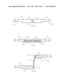 Decompressive Craniotomy Device and Methodology diagram and image