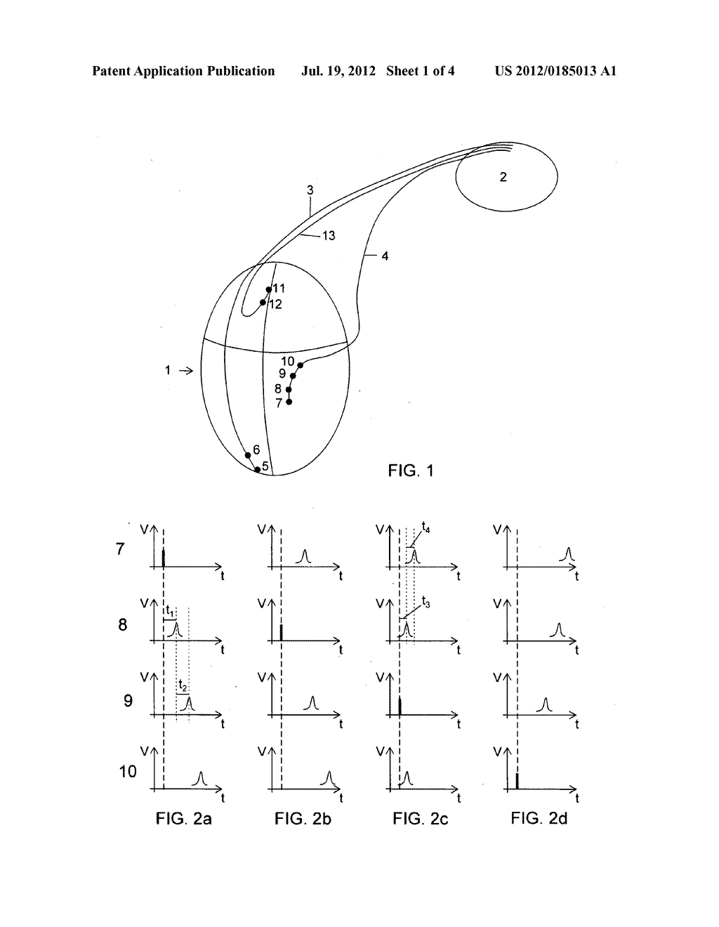 Heart Stimulating Device with Selecting Optimal Electrode Configuration - diagram, schematic, and image 02