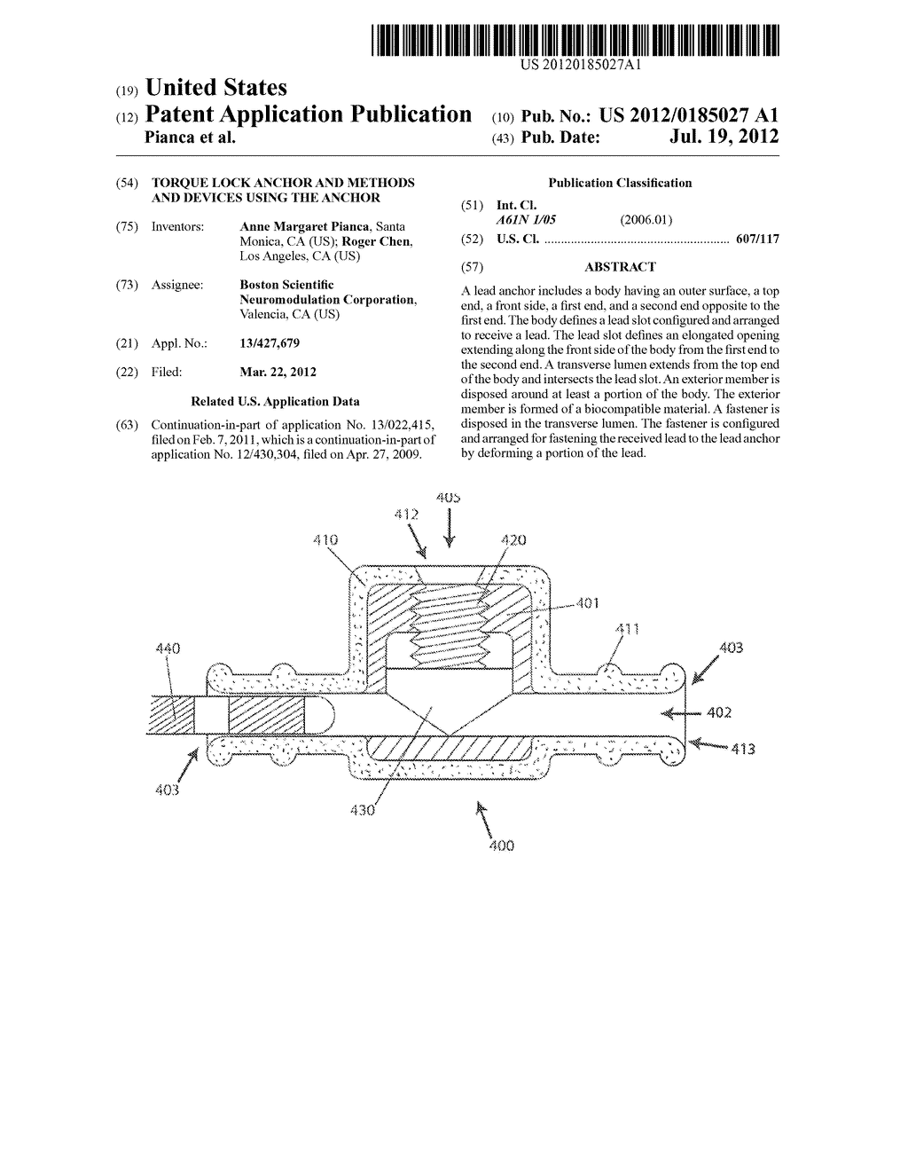 TORQUE LOCK ANCHOR AND METHODS AND DEVICES USING THE ANCHOR - diagram, schematic, and image 01