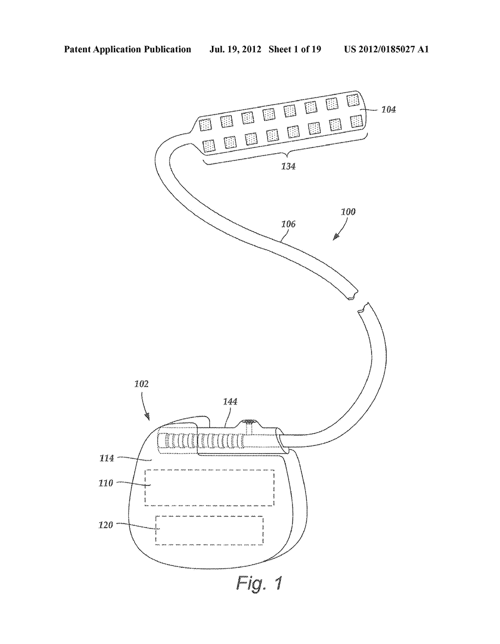 TORQUE LOCK ANCHOR AND METHODS AND DEVICES USING THE ANCHOR - diagram, schematic, and image 02