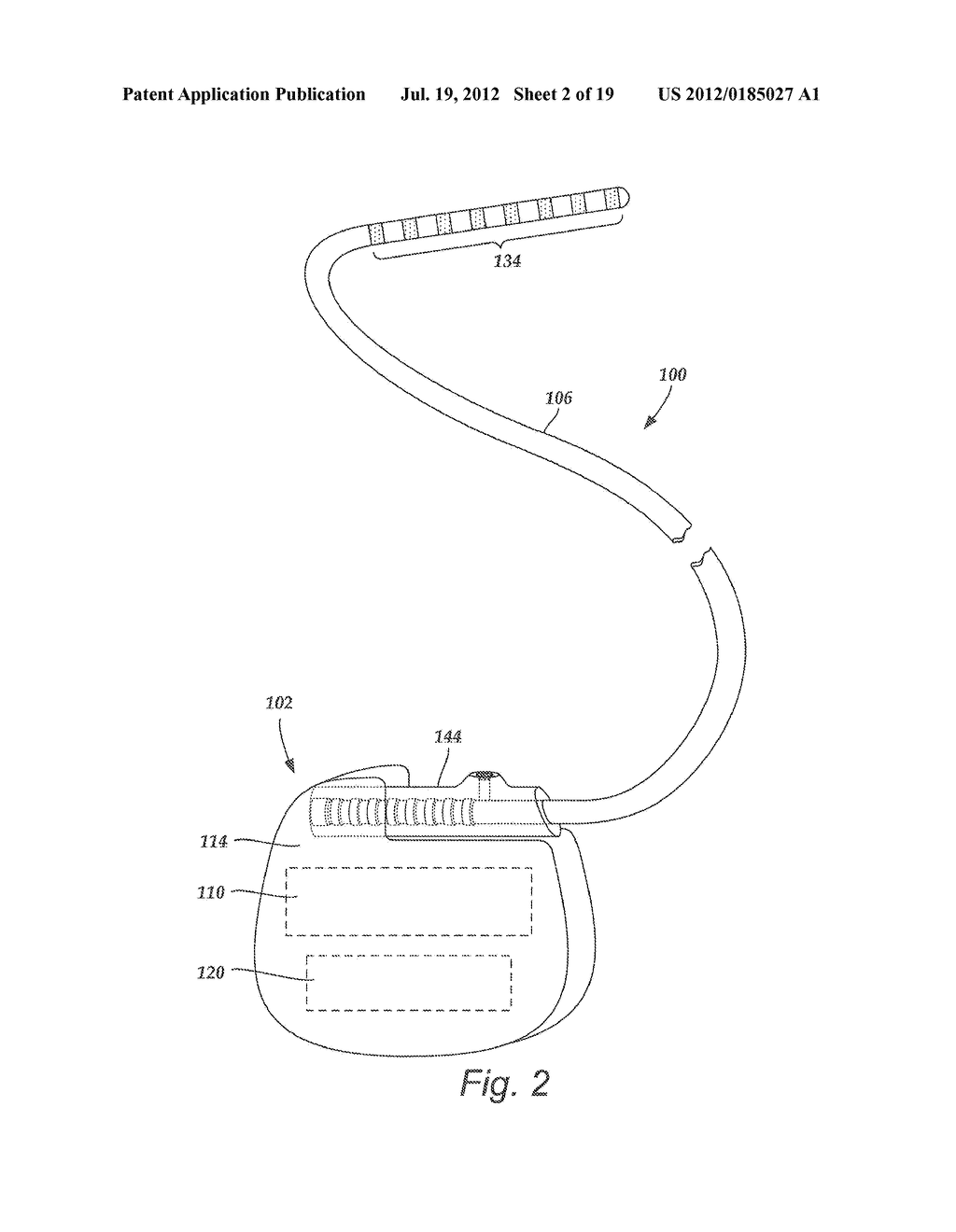 TORQUE LOCK ANCHOR AND METHODS AND DEVICES USING THE ANCHOR - diagram, schematic, and image 03