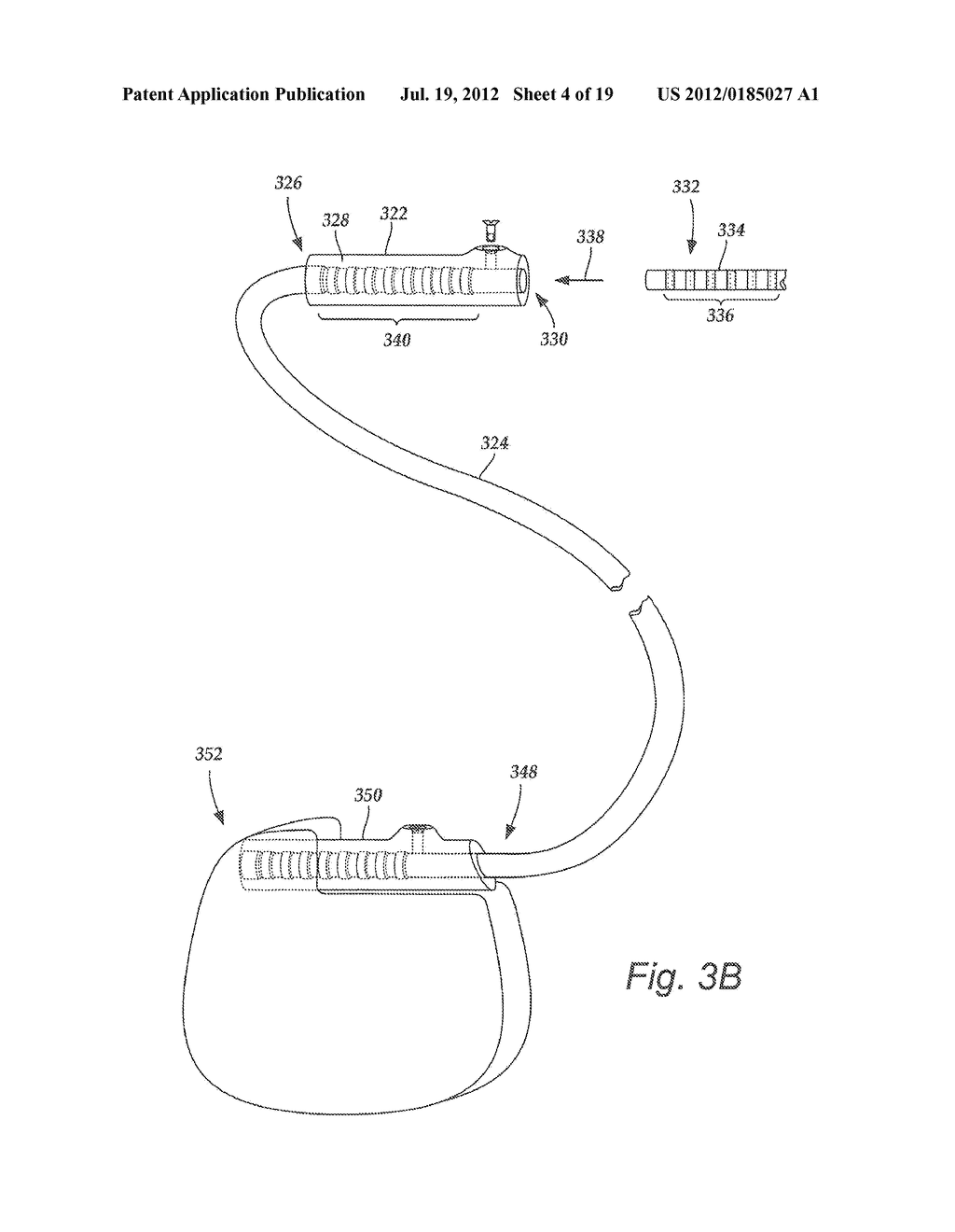 TORQUE LOCK ANCHOR AND METHODS AND DEVICES USING THE ANCHOR - diagram, schematic, and image 05