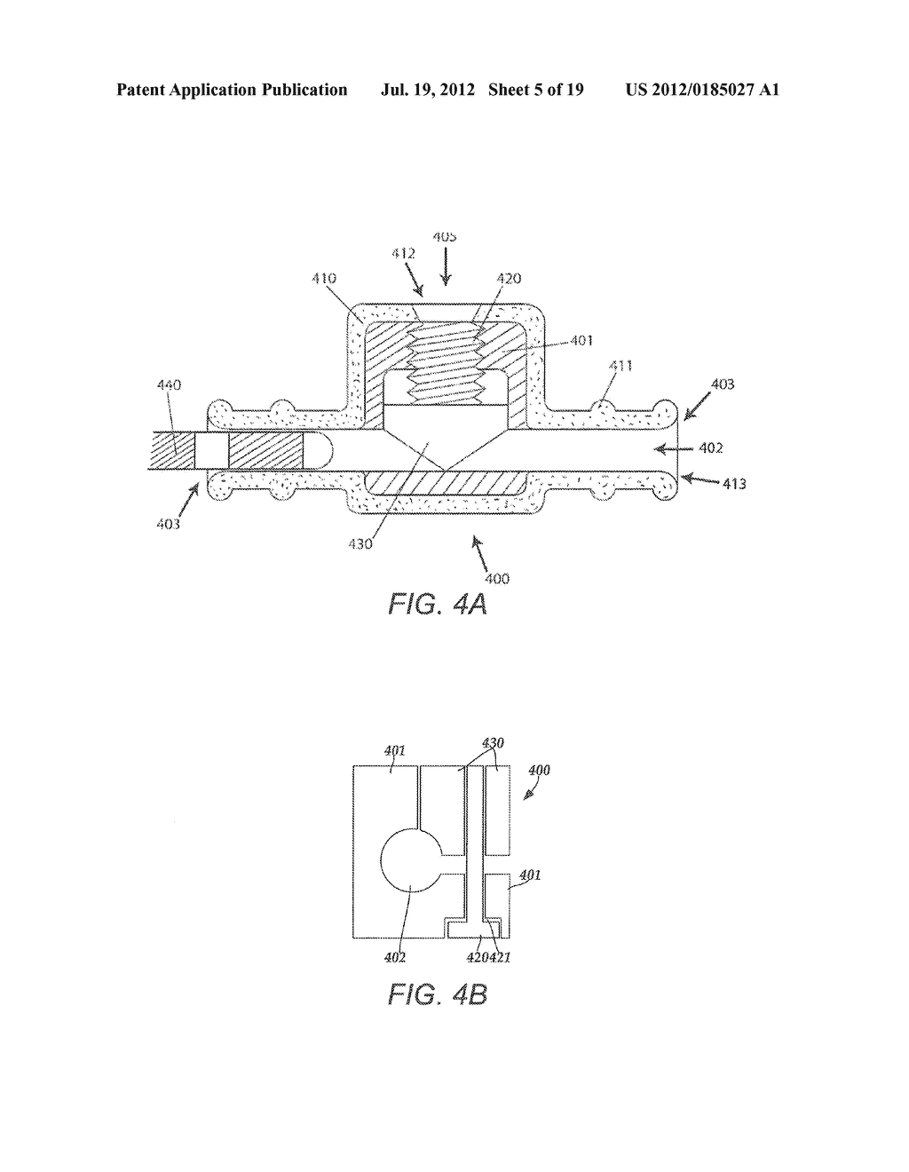 TORQUE LOCK ANCHOR AND METHODS AND DEVICES USING THE ANCHOR - diagram, schematic, and image 06