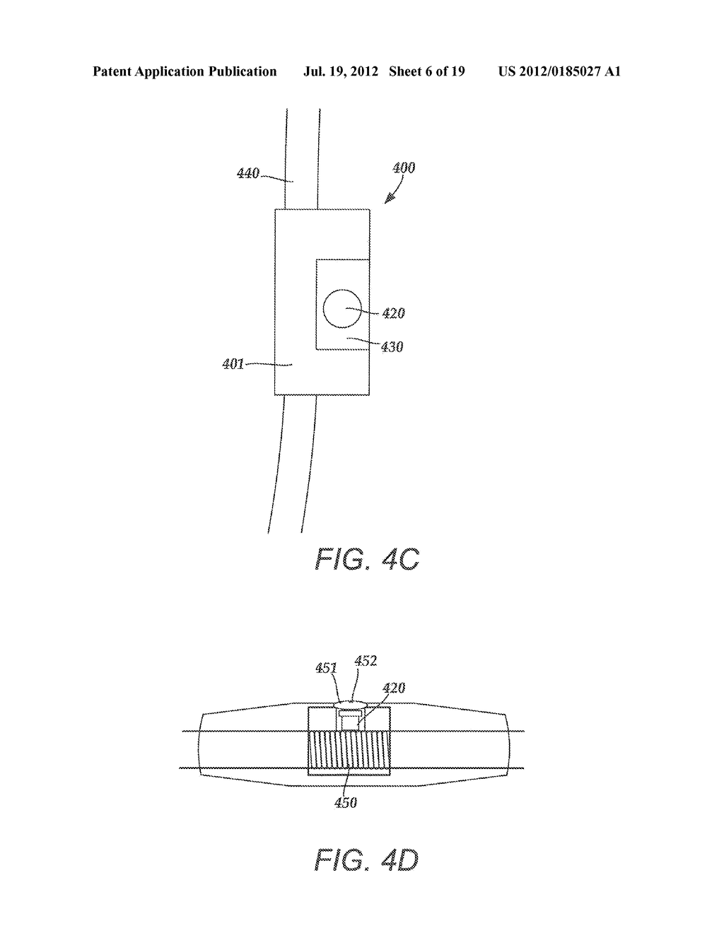 TORQUE LOCK ANCHOR AND METHODS AND DEVICES USING THE ANCHOR - diagram, schematic, and image 07
