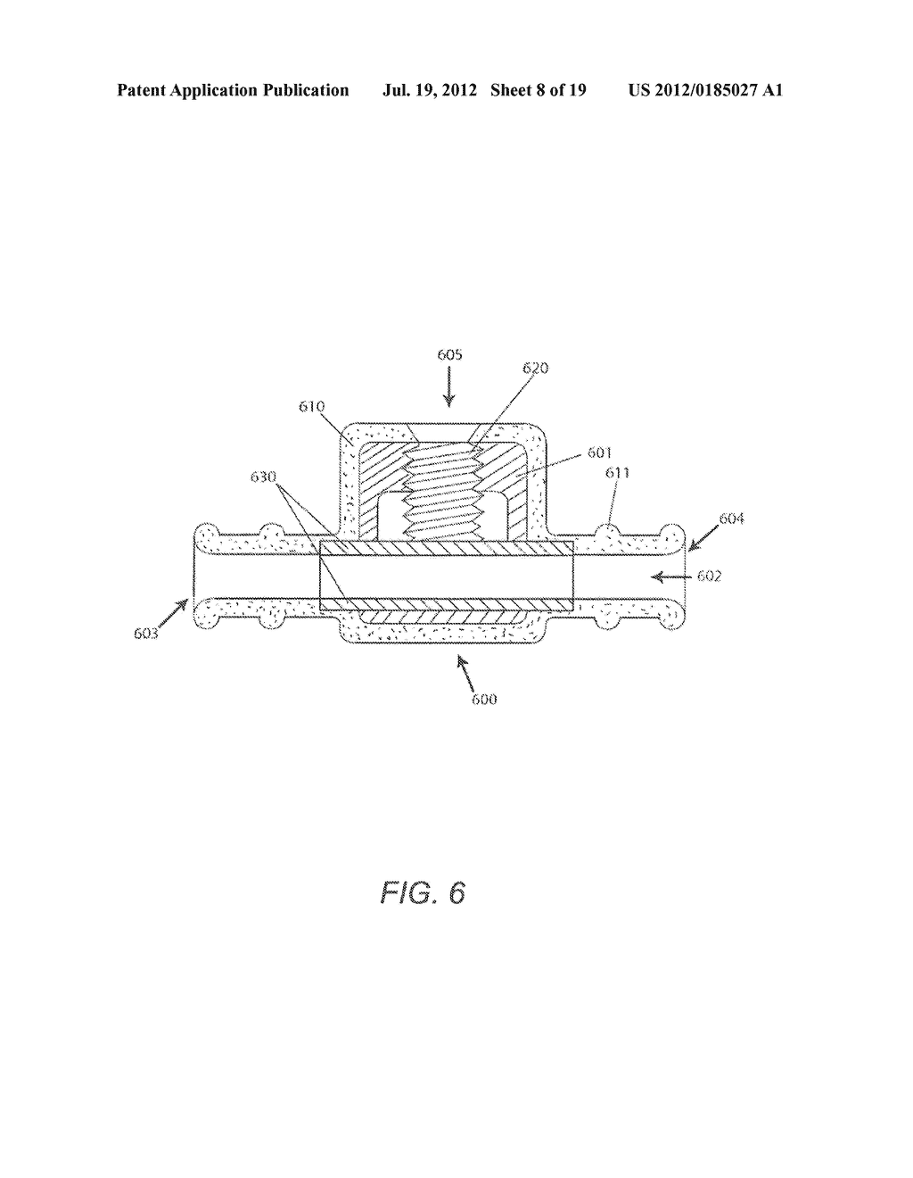 TORQUE LOCK ANCHOR AND METHODS AND DEVICES USING THE ANCHOR - diagram, schematic, and image 09