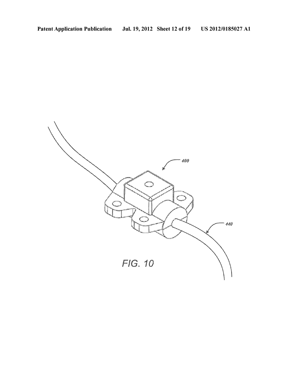 TORQUE LOCK ANCHOR AND METHODS AND DEVICES USING THE ANCHOR - diagram, schematic, and image 13