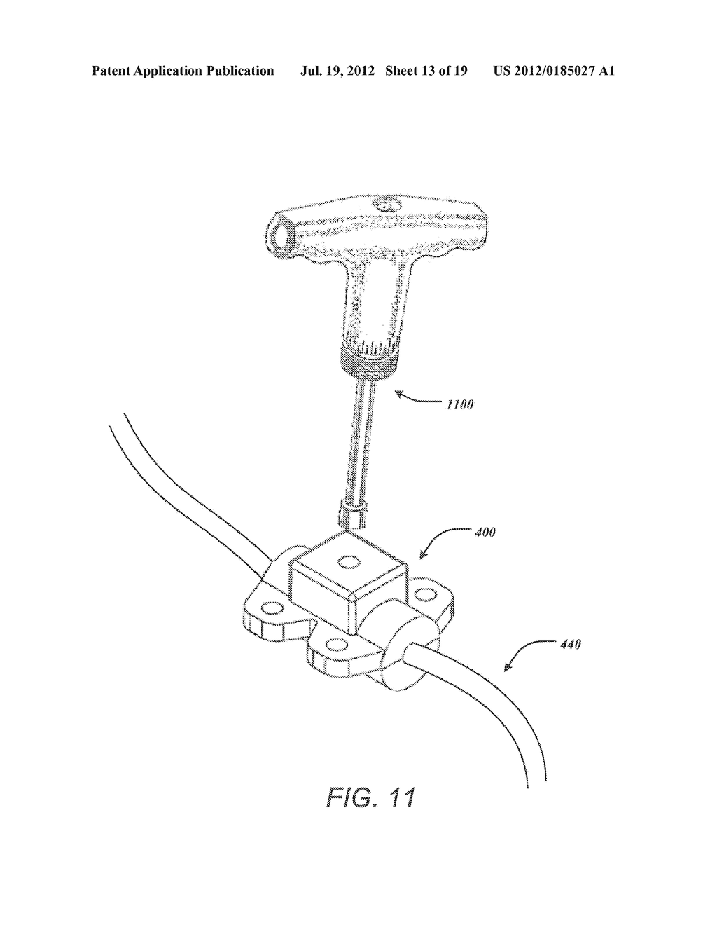 TORQUE LOCK ANCHOR AND METHODS AND DEVICES USING THE ANCHOR - diagram, schematic, and image 14