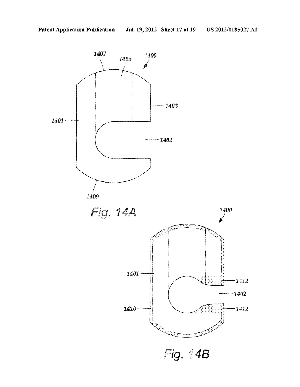 TORQUE LOCK ANCHOR AND METHODS AND DEVICES USING THE ANCHOR - diagram, schematic, and image 18