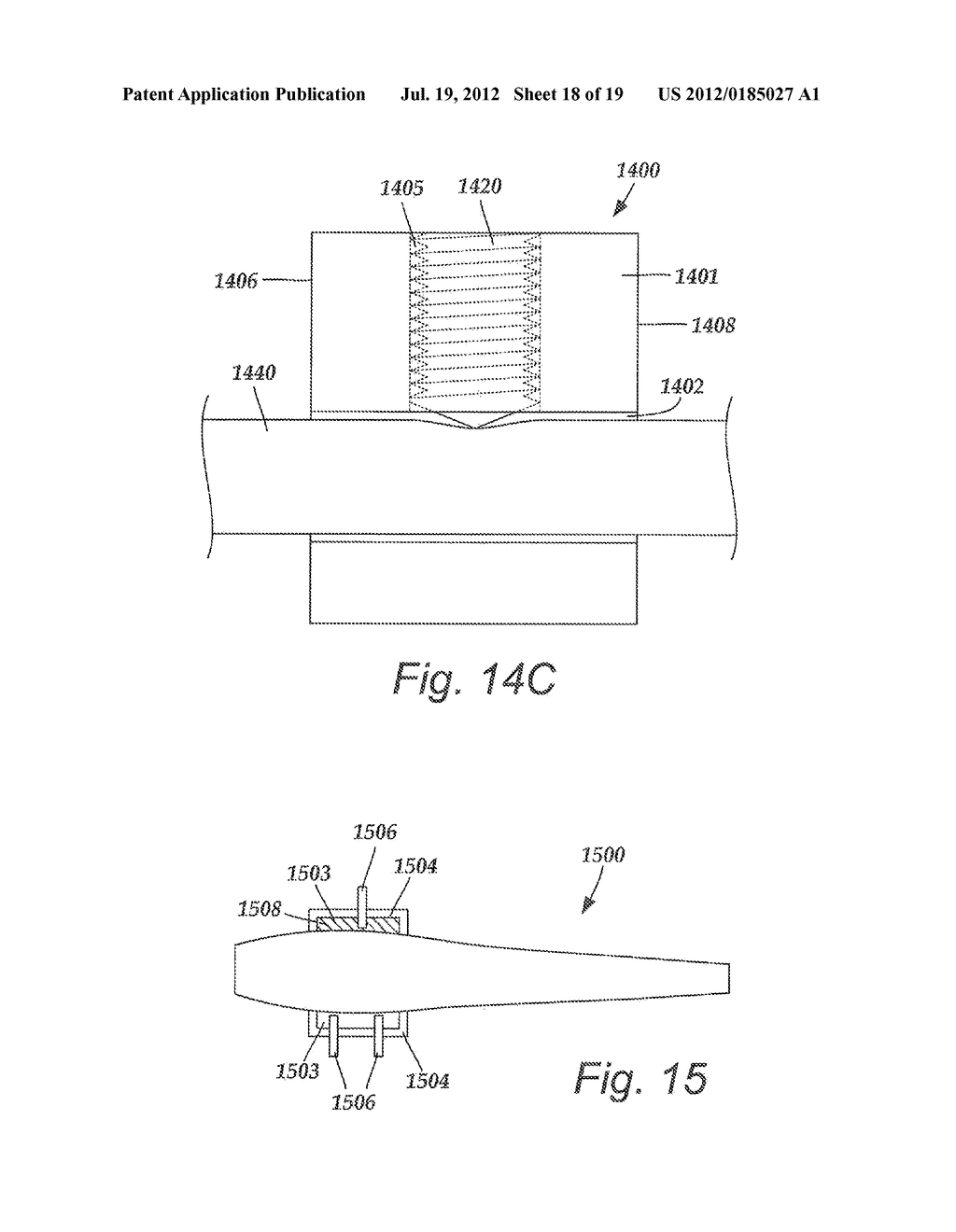 TORQUE LOCK ANCHOR AND METHODS AND DEVICES USING THE ANCHOR - diagram, schematic, and image 19