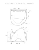 MEDIAL PIVOT POSTERIOR STABILIZED KNEE IMPLANT SYSTEM diagram and image