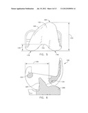 MEDIAL PIVOT POSTERIOR STABILIZED KNEE IMPLANT SYSTEM diagram and image