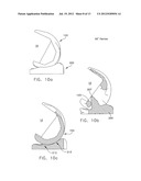 MEDIAL PIVOT POSTERIOR STABILIZED KNEE IMPLANT SYSTEM diagram and image