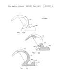 MEDIAL PIVOT POSTERIOR STABILIZED KNEE IMPLANT SYSTEM diagram and image