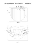 DENTAL ANALYSIS METHOD AND SYSTEM diagram and image