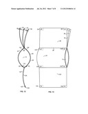 Layered and Secureable Spare Flaps for Rest Supports diagram and image